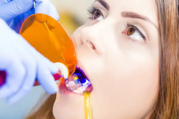 Close up of a woman receiving dental bonding procedure