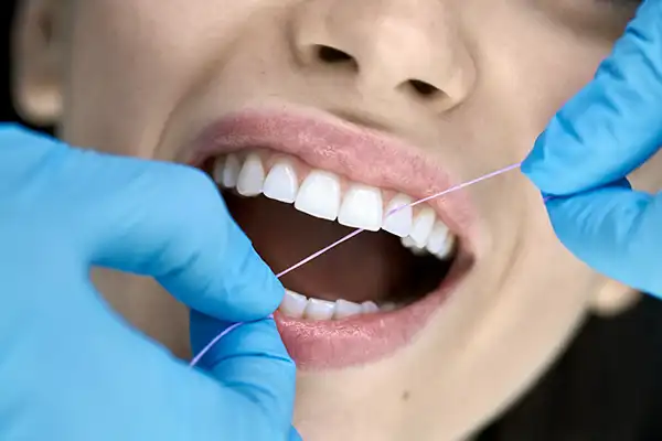 A tooth cleaning being performed on a woman with floss