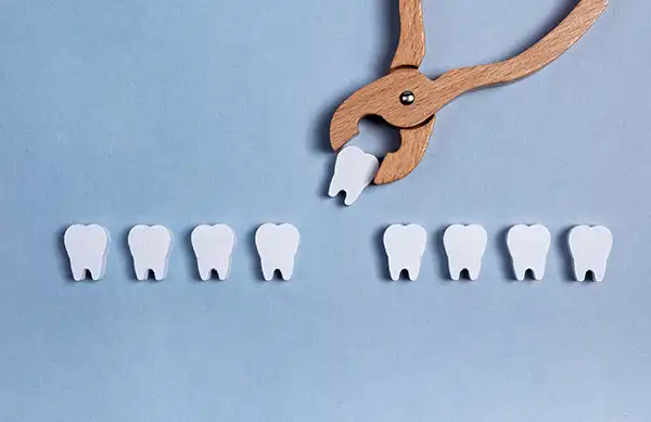 One tooth being plucked out of a series of healthy teeth