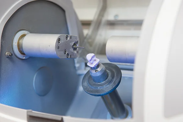 Photo of dental crown being made at Highridge Dental Care in Folsom, CA